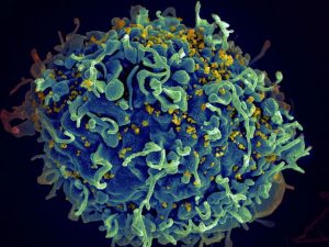 1HIV