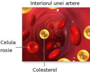 1colesterol