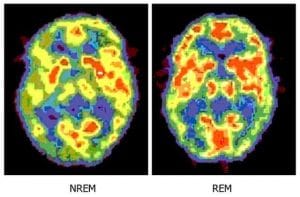 brain_NEW