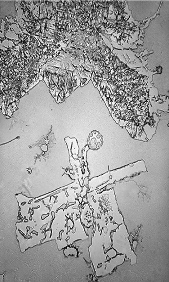 Lacrimi de eliberare