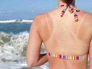Cele 10 remedii naturale pentru ARSURILE SOLARE la care nu te-ai gandit pana acum!