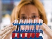 O noua amenintare pentru om din cauza unui animal. Au fost infectati cu hepatita