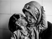 Fotografia care a lasat FARA CUVINTE o lume intreaga! DOVADA ca dragostea invinge durerea orice ar fi!