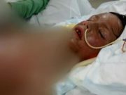 VERDICT INCREDIBIL! Un copil va ORBI dupa ce a luat o singura doza de Nurofen! IMAGINI care va pot afecta emotional! FOTO + VIDEO