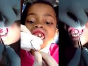 Nu te speli pe dinti? Iata ce poate creste in gingie! VIDEO