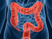 Nu ignora niciodata aceste simptome mai putin evidente ale cancerului de colon!
