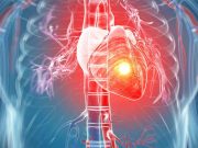 Usturoiul si lamaia pot preveni atacul de cord, accidentul vascular cerebral si alte afectiuni!