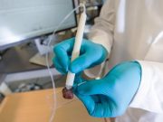 Descoperirea oamenilor de stiinta americani poate schimba istoria medicinei! Cancerul, depistat in 10 secunde!
