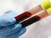 Descoperirea care ar putea schimba istoria medicinei! O noua metoda ce ar putea vindeca leucemia!