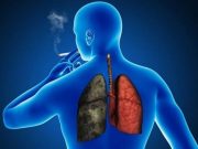 „Barometrul” la indemana fiecaruia pentru cancerul pulmonar! Arata multe despre efectele fumatului asupra plamanilor!