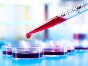 Testul care descopera 70% din cazurile de cancer!