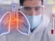 Descoperirea medicilor olandezi care arata cum se transmite noul coronavirus. Nu gura este poarta de intrare in corp!